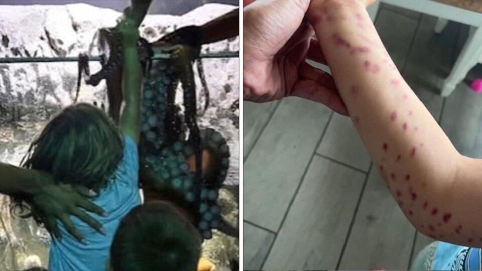 Mother says son injured after octopus latches on during aquarium visit