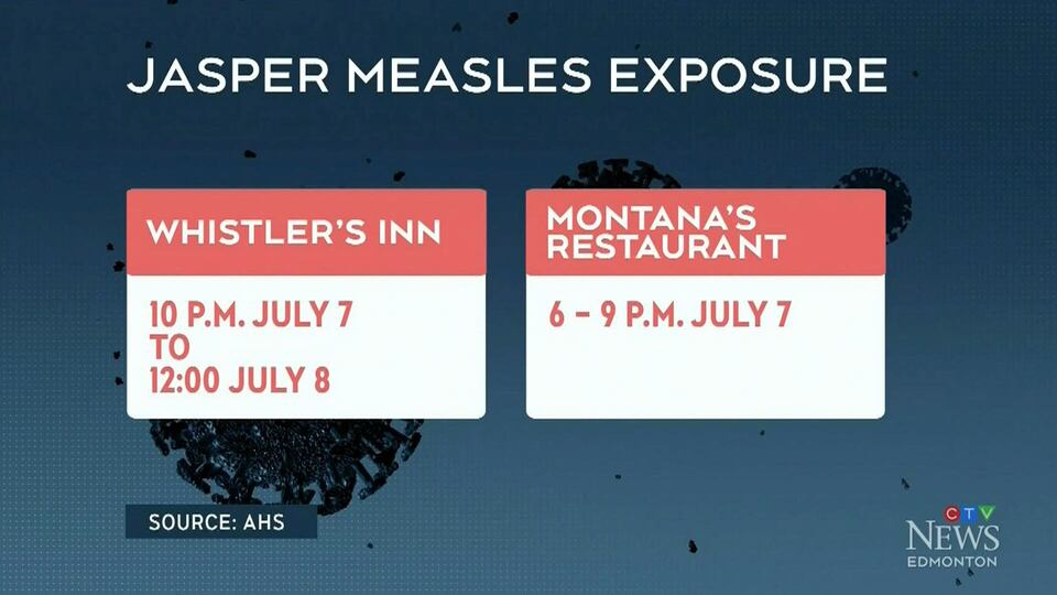 Potential measles exposure in Jasper, Alta.