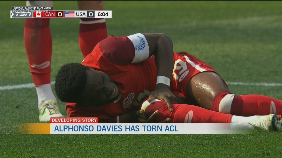 Alphonso Davies out with a torn ACL