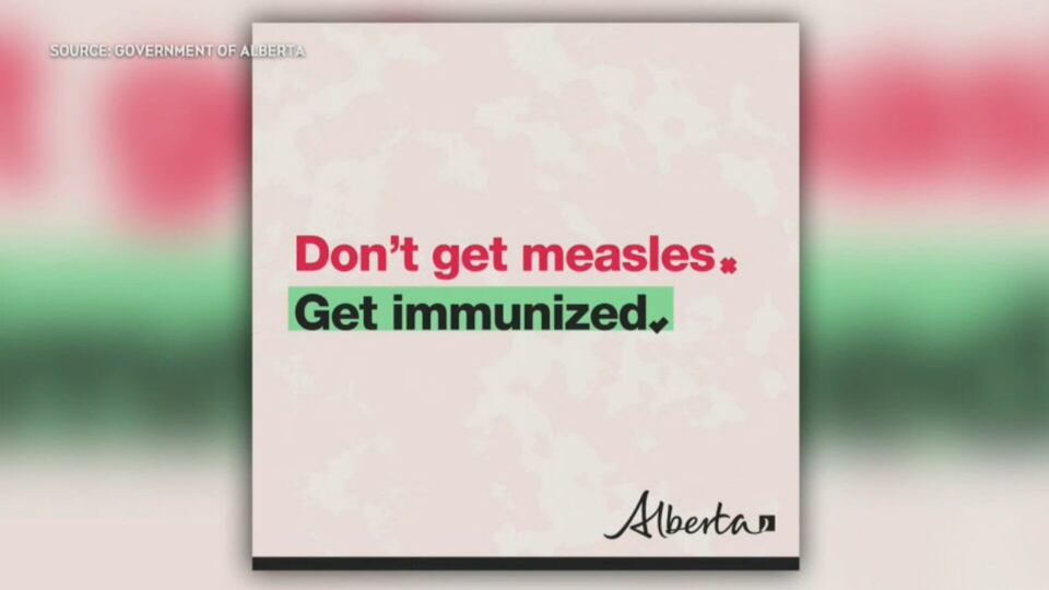 Vaccination urged as measles cases surge