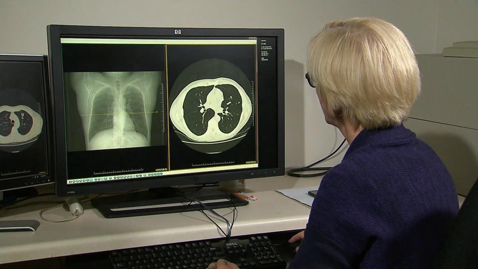 New immunotherapy drug used to treat several forms of cancer approved by Health Canada