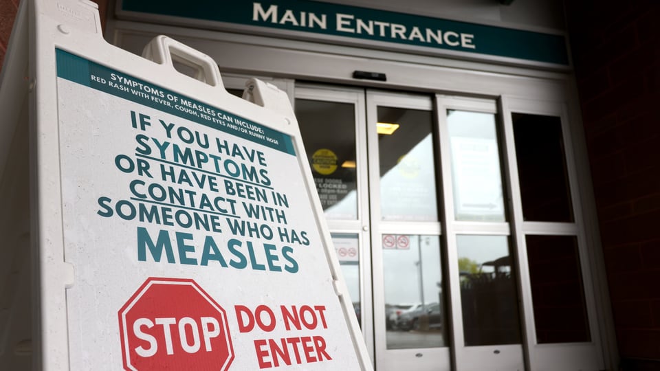 Canada facing nearly three times as many measles cases as the U.S.