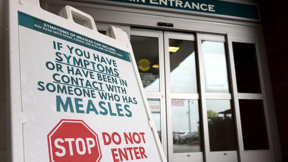 Alberta is reporting more measles cases than all of the U.S.